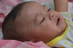 a baby lying on a blanket